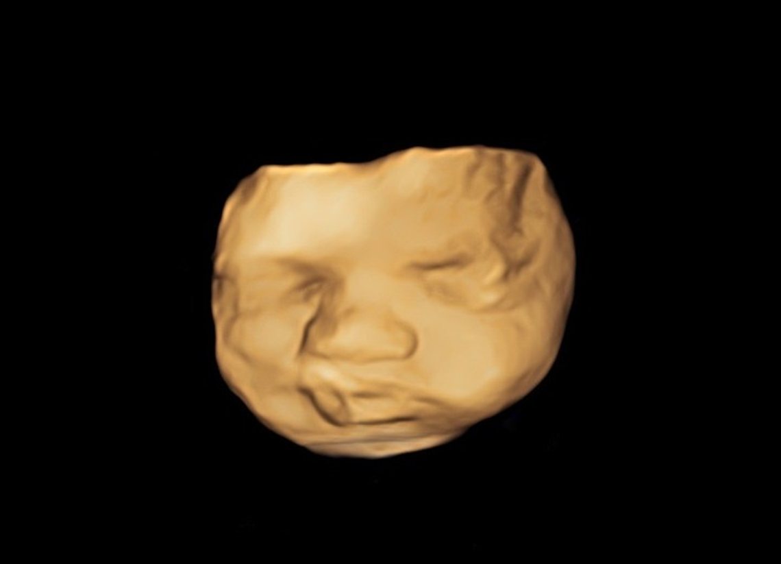 A warm, glowing 3D ultrasound render of a baby's face.